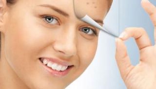 وصفات وطرق طبيعية للتخلص من الرؤوس السوداء