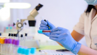 اختبار دم بسيط قادر على تحديد موعد وفاتك - أرشيفية