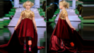 طفلة مبتورة الساقين نجمة أسبوع الموضة في نيويورك