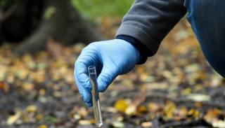 حالات الإصابة تتركز في ولاية النيل الأزرق - أرشيفية