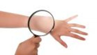 خلايا مناعية تسهم في علاج سرطان الجلد