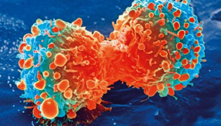 الخلايا السرطانية خلال انقسامها - أرشيفية