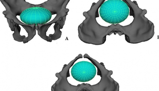 النماذج ثلاثية الأبعاد كشفت أن قناة الولادة كانت أوسع عند أسلاف البشر