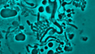 البكتريا في شكل الحرف "L"