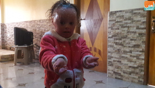 الطفلة غفران تشعر بآلام شديدة طوال اليوم 