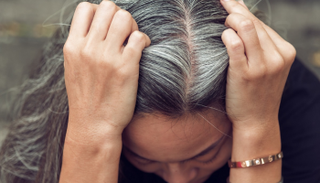 شيب الشعر أحد الآثار التي يتركها التوتر على الجسم - أرشيفية