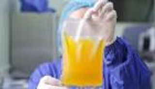 غرائب كورونا.. دراسة تفجر مفاجأة حول بلازما المتعافين