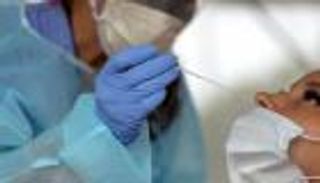 دراسة: عدوى "كوفيد-19" أصبحت أخف وطأة بمرور الوقت