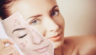 الندبات هي نوع من الأنسجة البديلة التي ينتجها الجسم لإغلاق الجروح