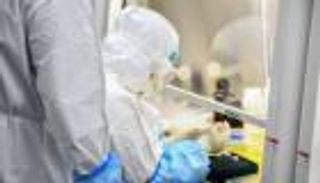 كيف يؤثر كورونا على خصوبة الرجال؟