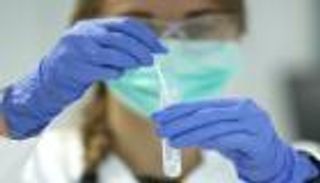 رقم قياسي جديد لإصابات كورونا حول العالم