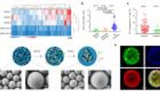خبر سار.. لقاح علاجي جديد لسرطان الدم