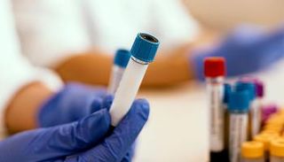 السبب المباشر لوفاة الطفلة لا يزال مجهولا حاليا - أرشيفية