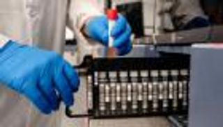 علماء يتعمدون إصابة متطوعين بكورونا.. ميزة عظيمة