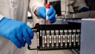 تجربة لإصابة متطوعين بفيروس كورونا