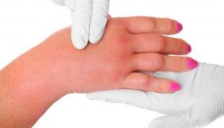  أسباب وطرق التخلص من احتباس الماء بالجسم