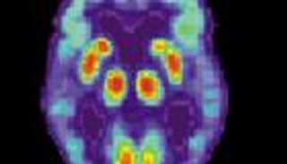 فأر يحمل البشرى بلقاح جديد لوقف تقدم ألزهايمر