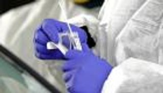 1237 وفاة جديدة بكورونا في أمريكا.. وزيادة قياسية بإصابات إيطاليا