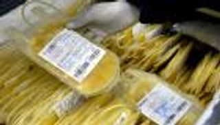 نتائج صادمة.. بلازما المتعافين ليس لها فائدة كعلاج لكورونا