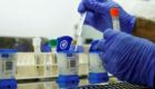 المناعة بعد الإصابة.. لغز كورونا الأكبر بين أيدي العلماء