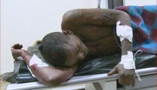 المصاب جراء الانفجار