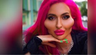 عارضة الأزياء بعد عملية التجميل