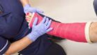 دراسة: النباتيون أكثر عرضة لكسور العظام