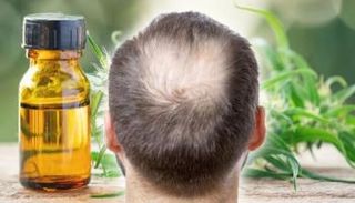 زيوت أساسية لنمو الشعر