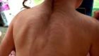 خطأ طبي يحول أطفال إسبانيا إلى "غوريلا"