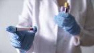 بعد طفرة بالإصابات.. كورونا يغلق المدارس والجامعات في موريتانيا
