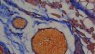 السر في "سم نحل العسل".. طريقة مبتكرة لوصول الدواء للجسم