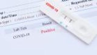اختبار جديد يصطاد كورونا في 20 دقيقة