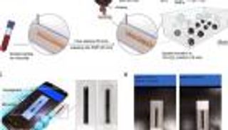 هل يصبح هاتفك الذكي أسرع طريقة لتشخيص العدوى الفيروسية؟