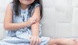 أعراض الصدفية عند الأطفال.. انتبه لخطر أمراض القلب والسكري