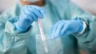 7 وفيات و788 إصابة جديدة بكورونا في ليبيا