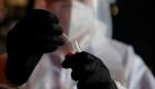 فرنسا تسجل أول إصابة بسلالة كورونا الجنوب أفريقية