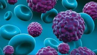 لا توجد أغذية خارقة يمكن أن تمنع الإصابة بمرض السرطان