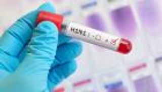 وفاة 5 تونسيين بفيروس H1N1