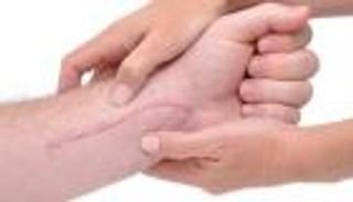 ظهور الندبات في الجسم.. الأسباب والأنواع وطرق العلاج