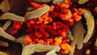 أول صور مجهرية لكورونا