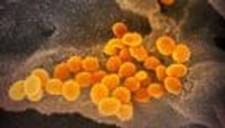 بحزمة طاقة.. هكذا التقط العلماء أول صورة لكورونا