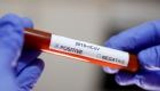 تعاون فرنسي أمريكي لتطوير لقاح يكافح "كورونا"