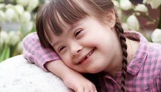 طفلة مصابة بمتلازمة داون - أرشيفية