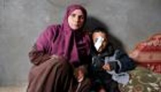 قناصة الاحتلال تطفئ نور أعين 21 فلسطينيا في عامين