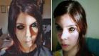 "وشم في العين" يُفقد فتاة بصرها.. قلدت مغنيا شهيرا