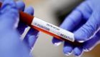 11 توصية للوقاية من كورونا في فلسطين.. أوقفوا التقبيل