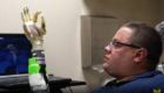 ذراع صناعية تحركها "أفكار" المريض تشبه "اليد الحقيقية"