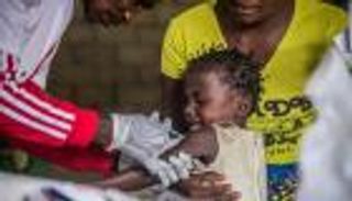 الحصبة تفترس الكونغو.. لن تصدقوا عدد الضحايا