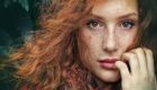 أسباب ظهور النمش في الوجه وطرق التخلص منه