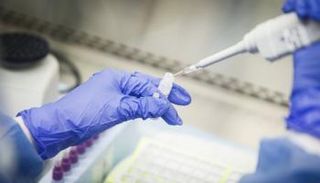 علماء يجرون أبحاثا عن فاعلية العلاج الجديد لمكافحة كورونا